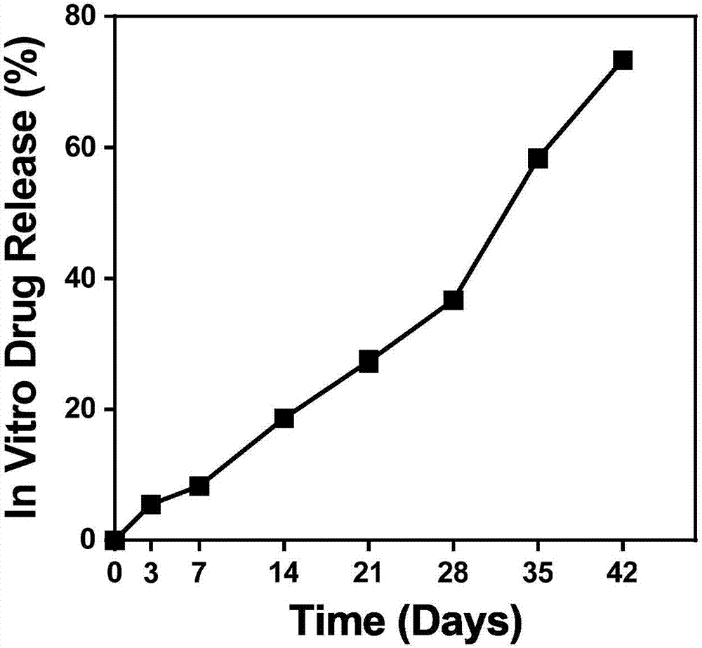 Injection containing triamcinolone acetonide and PLGA sustained release microspheres, preparation method of injection and application of injection to preparation of medicine for treating osteoarthritis pain