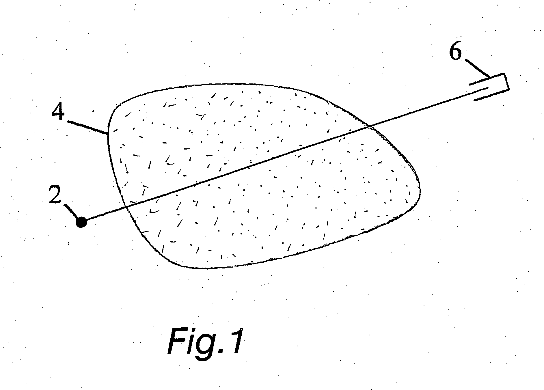 Method and arrangement for medical X-ray imaging