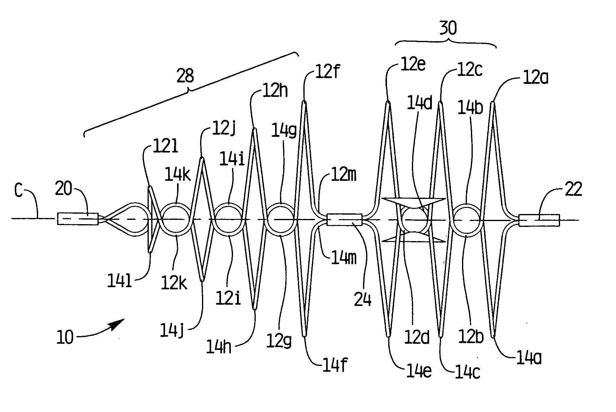 Removable vein filter