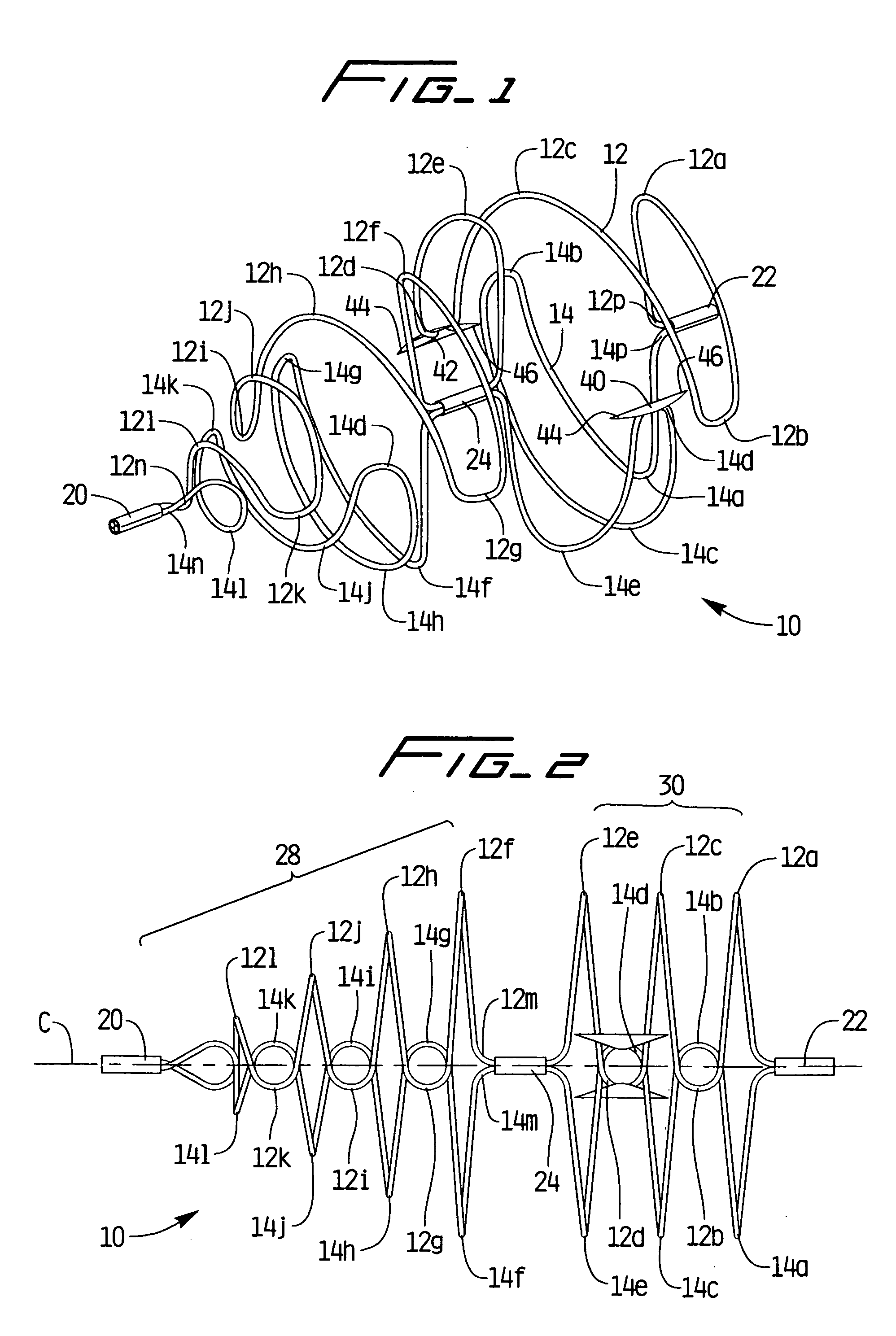 Removable vein filter