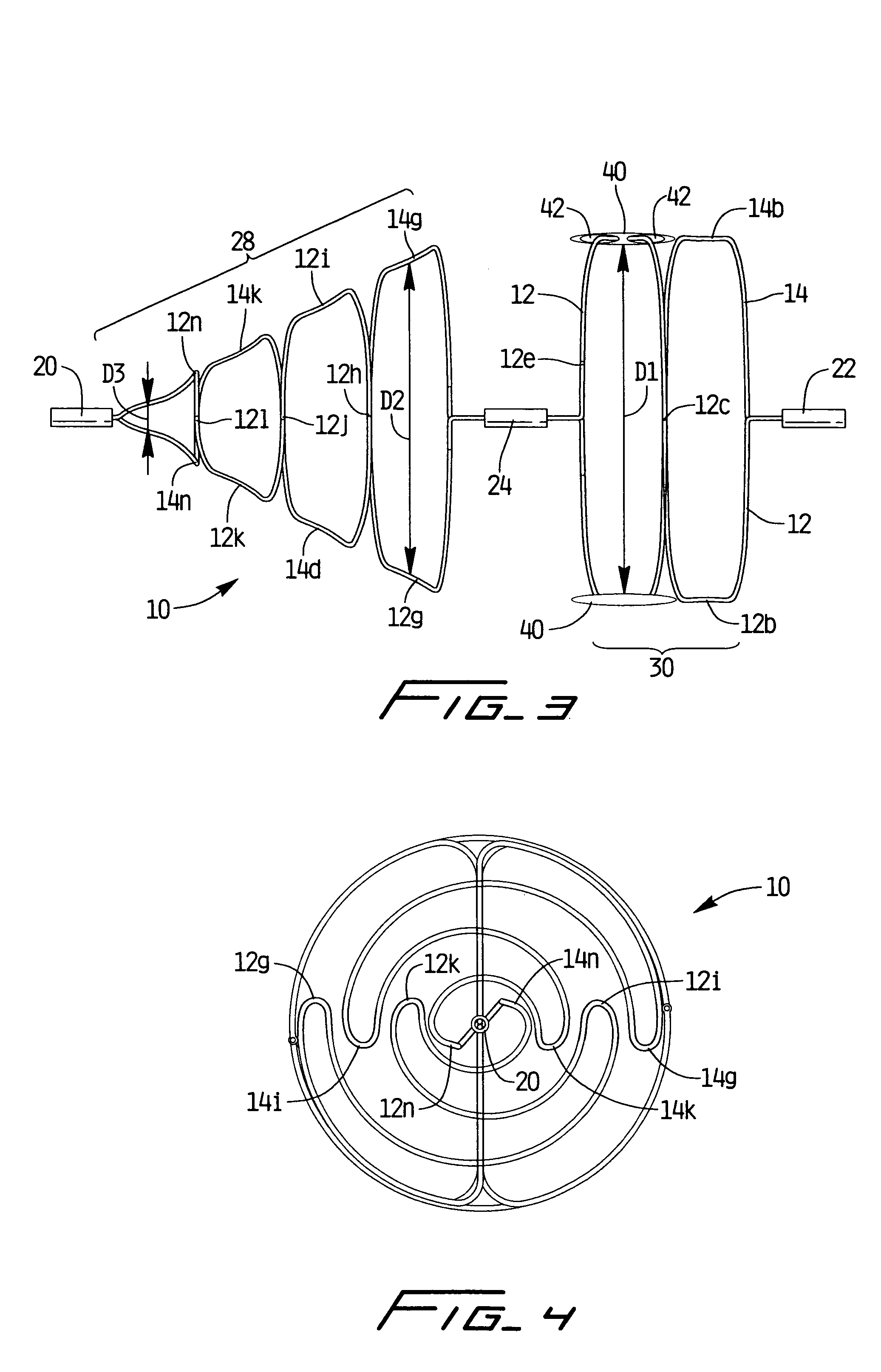 Removable vein filter