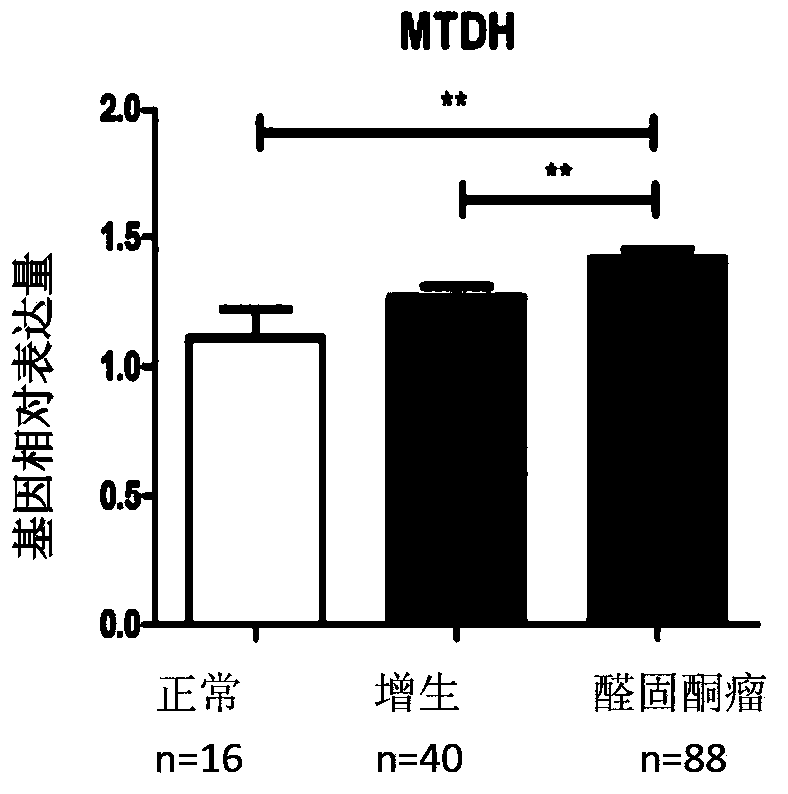 Application of MTDH to preparation or screening of drugs for curing hyperaldosteronism adenomata or adrenal tumors