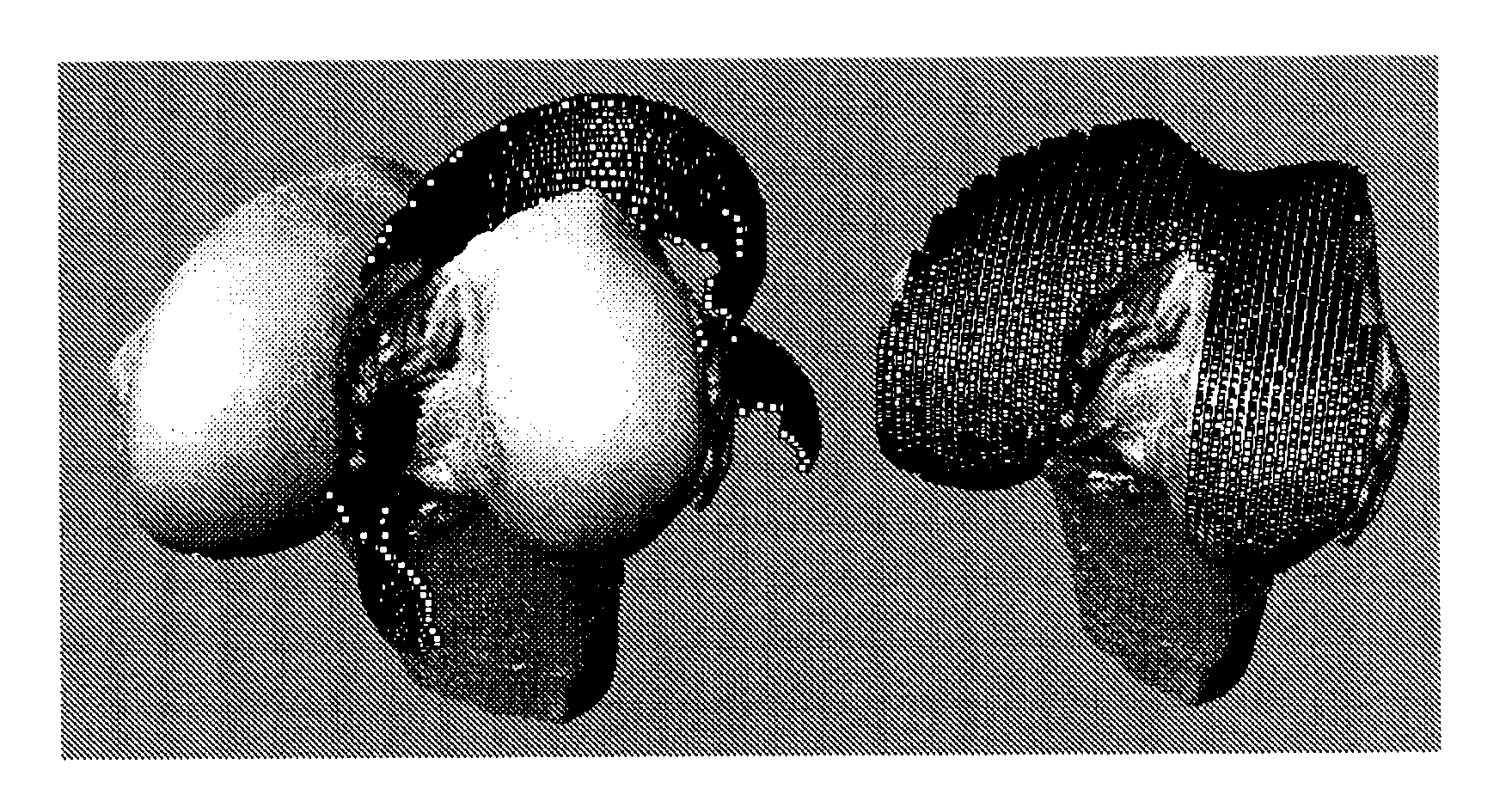 Methods for determining meniscal size and shape and for devising treatment