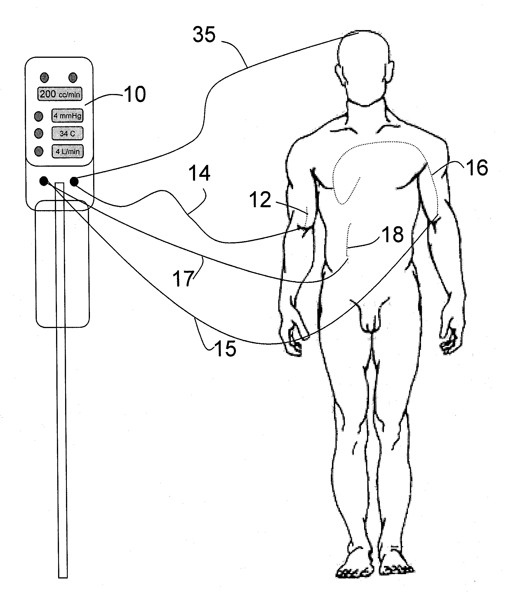 Automated Therapy System and Method