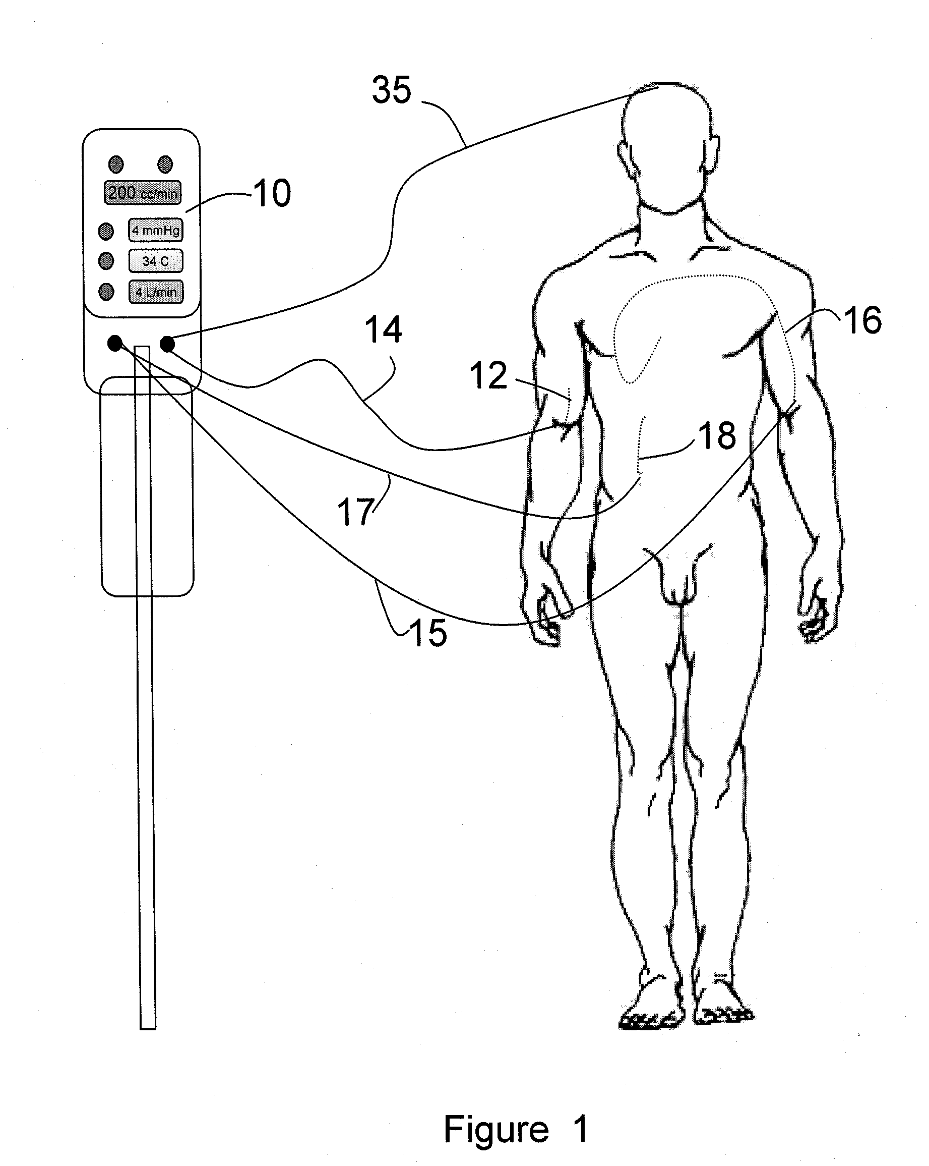 Automated Therapy System and Method