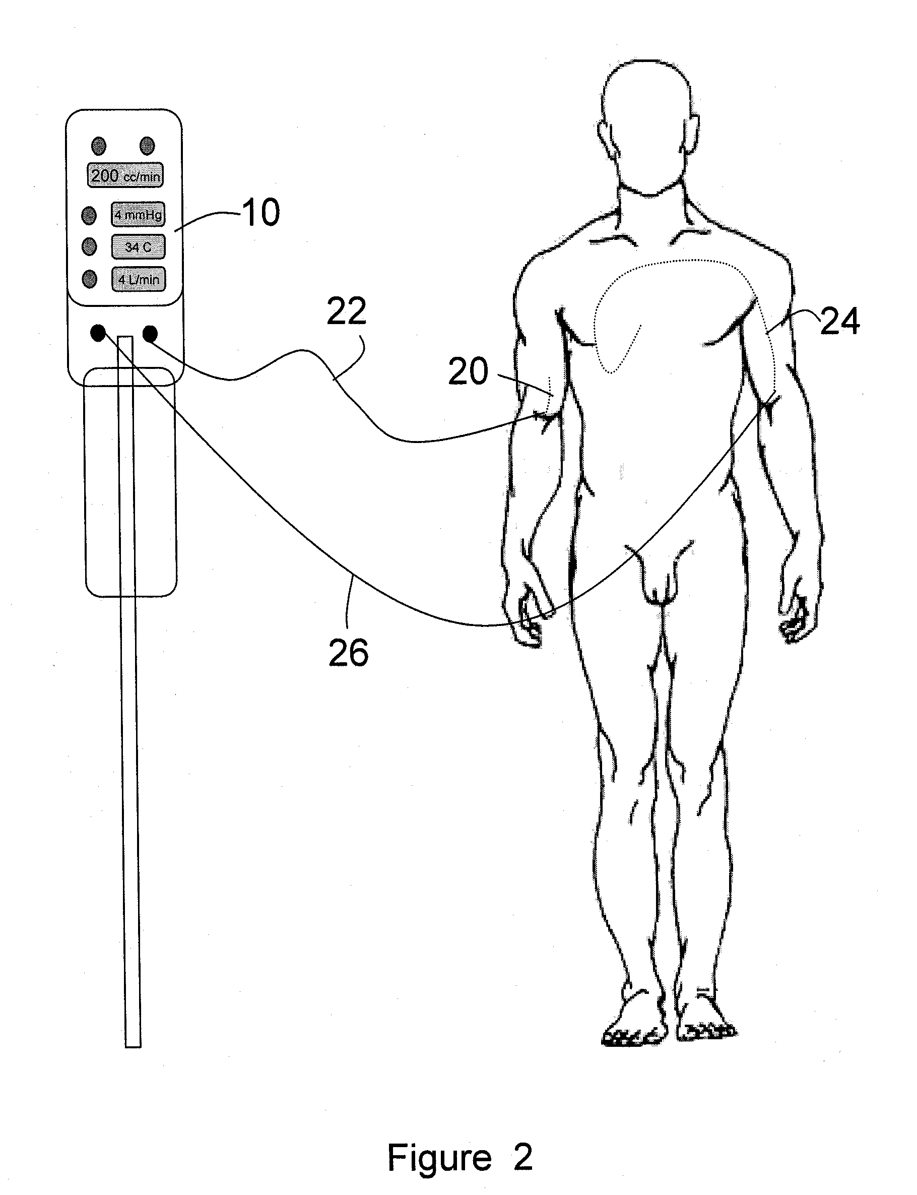 Automated Therapy System and Method