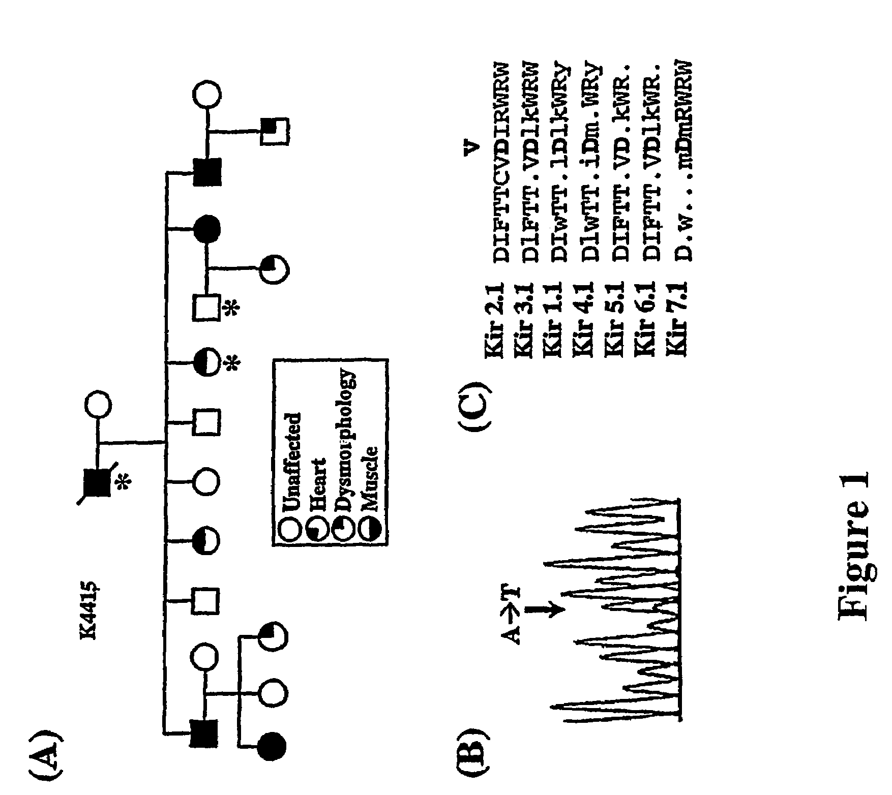 Methods for assessing risk for cardiac dysrythmia in a human subject