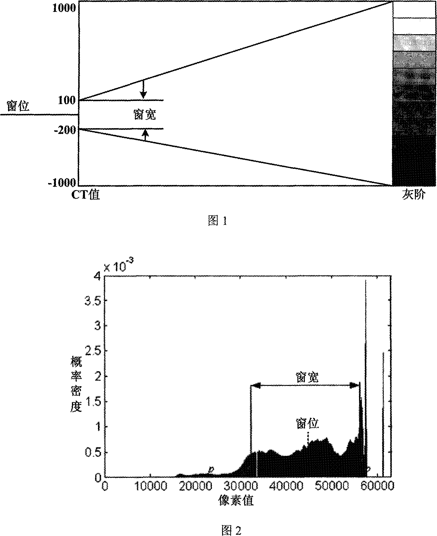 Medical image window parameter self-adaptive regulation method