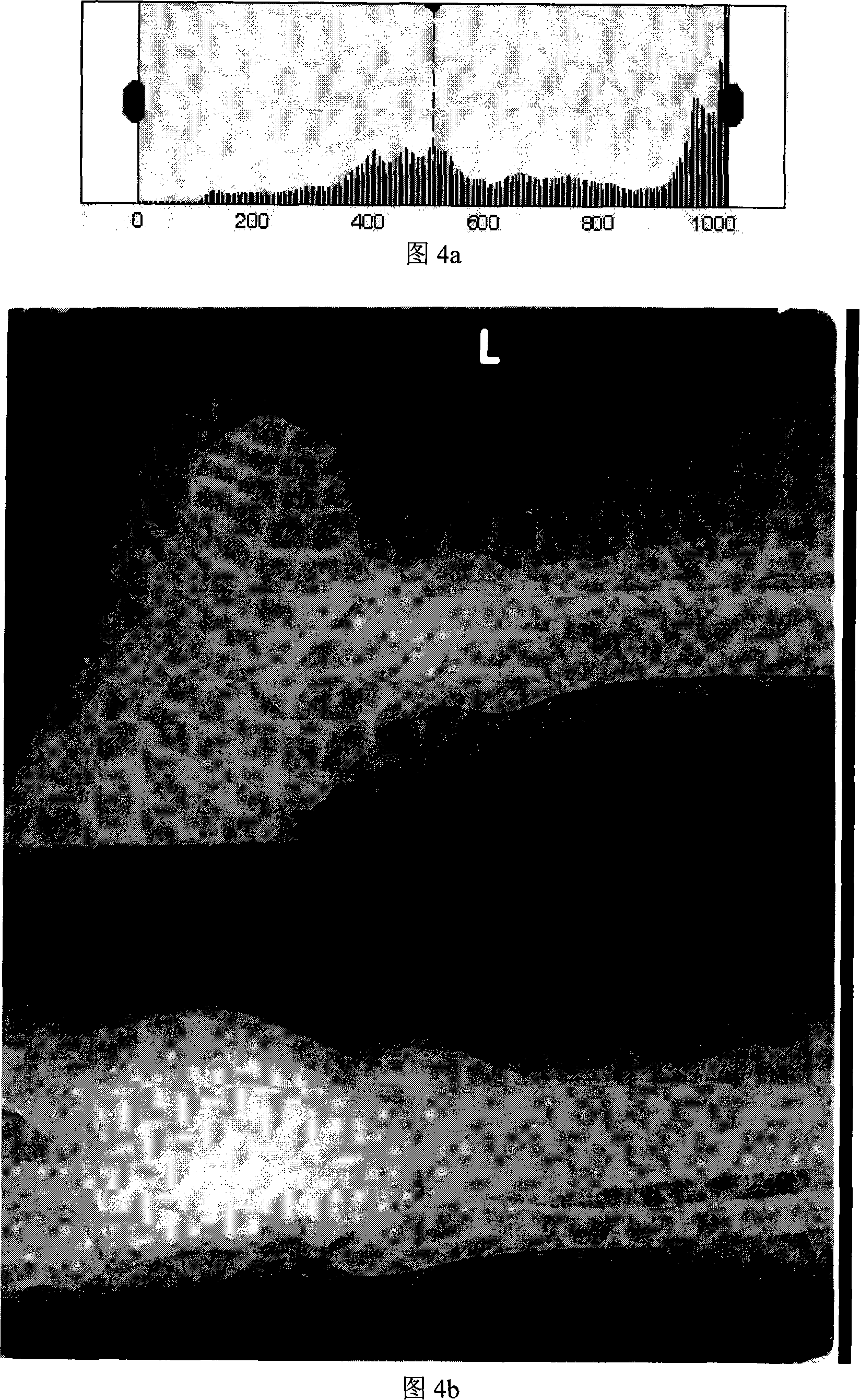 Medical image window parameter self-adaptive regulation method