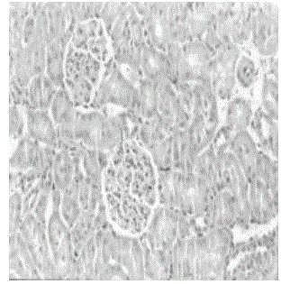 Traditional Chinese medicine composition for treating chronic nephritis proteinuria as well as preparation method and use thereof