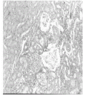 Traditional Chinese medicine composition for treating chronic nephritis proteinuria as well as preparation method and use thereof