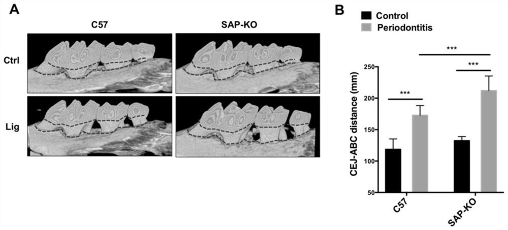 Application of SAP as diagnostic marker for periodontitis