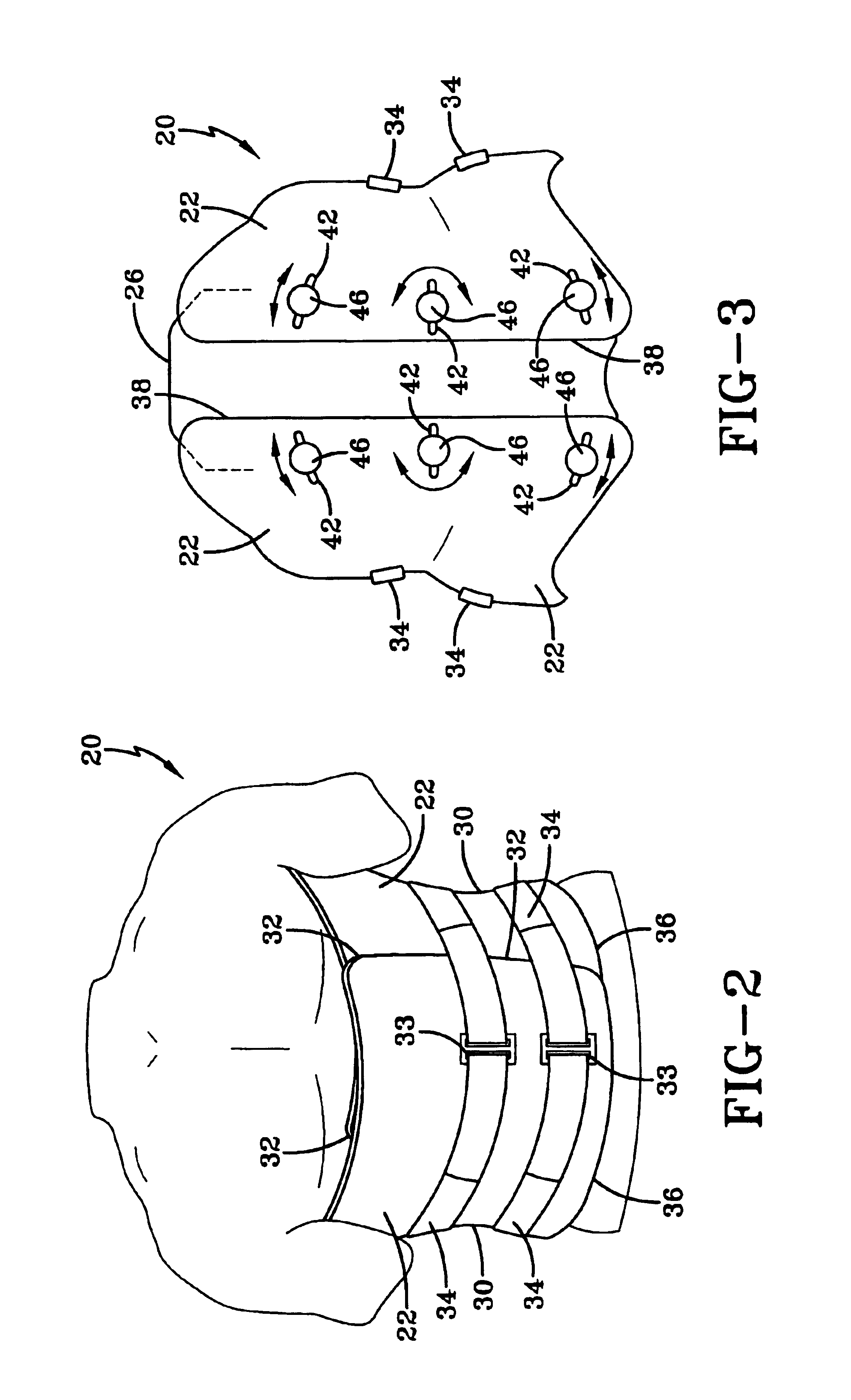 Orthosis for supporting spinal structures