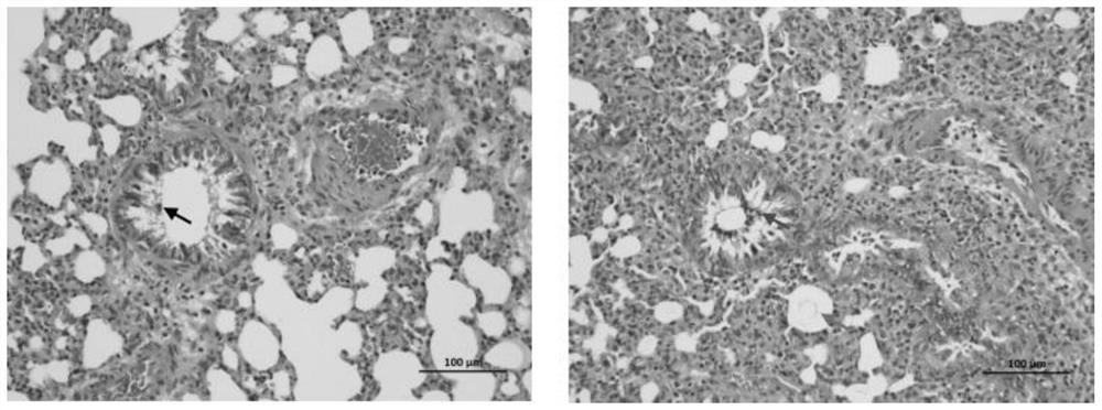 Application of ITPP in preparing medicines for preventing and/or treating ischemia-hypoxic injury and lung injury