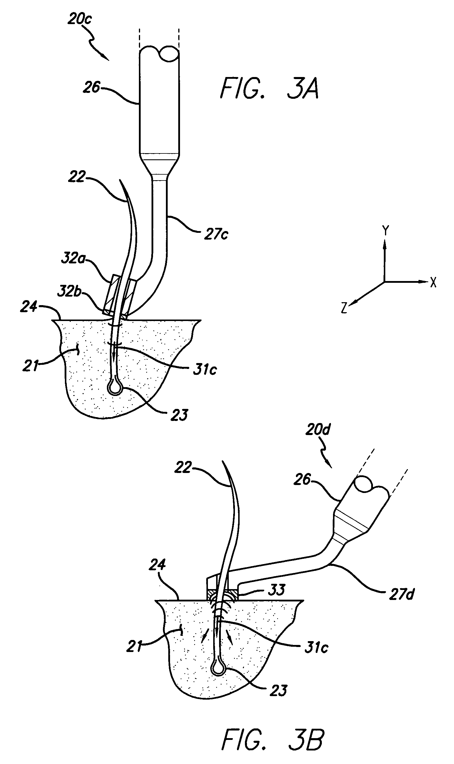 Hair-treatment or removal utilizing energy-guiding mechanisms