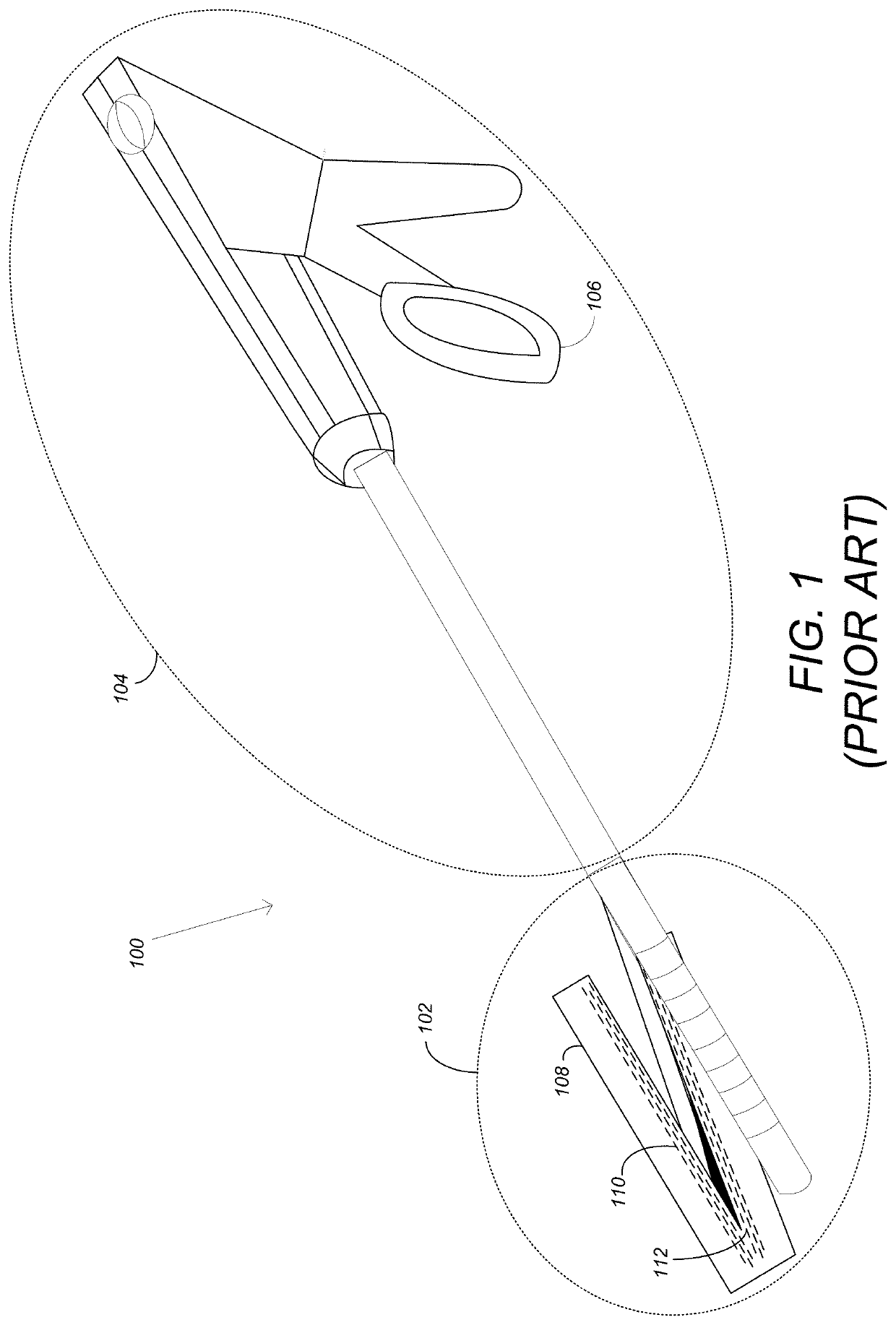 Automatic suture device to reduce bleeding in  gastric bypass surgery