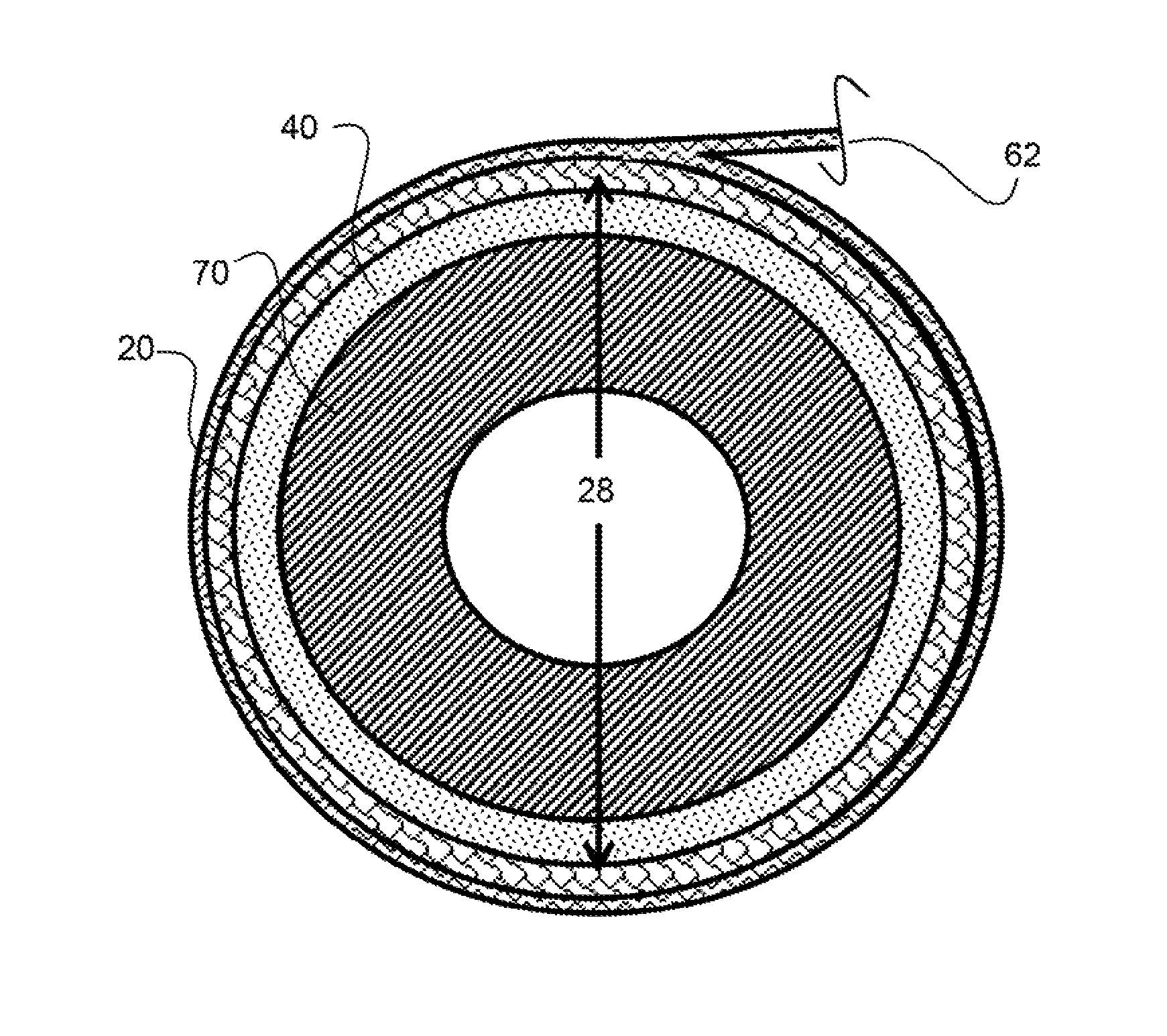 Radially compliant pressure indicating stent graft