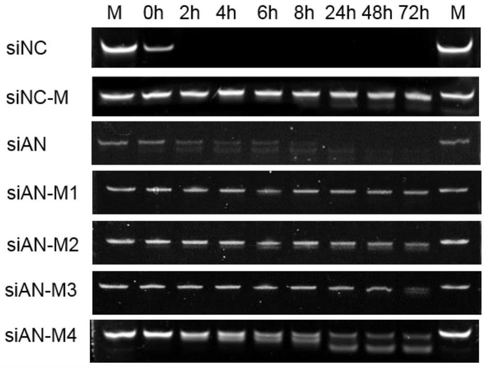 A kind of small interfering nucleic acid and pharmaceutical composition and application thereof