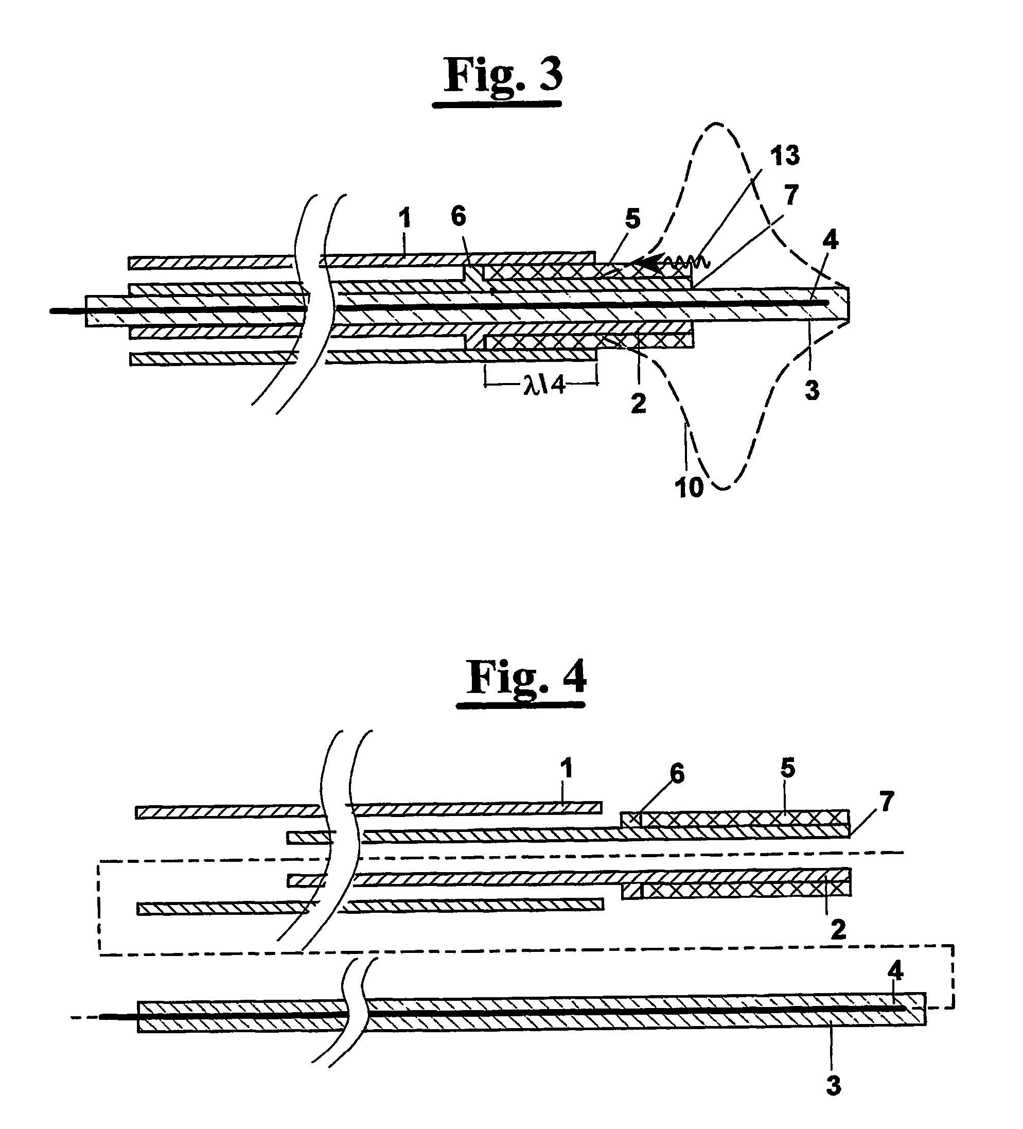 Interstitial microwave antenna with miniaturized choke hyperthermia in medicine and surgery