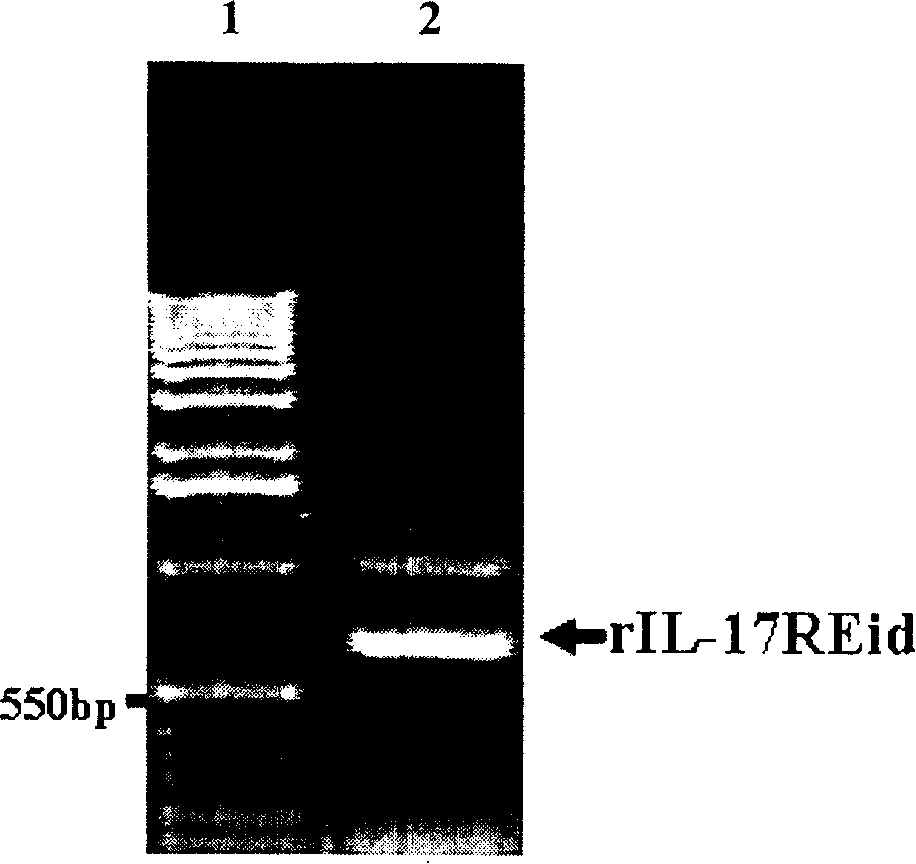 Rat's IL-17RE span film region and cell inner region poly peptide and coding sequence, fusion protein and clone