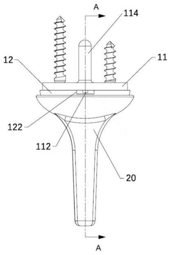 Wrist joint prosthesis