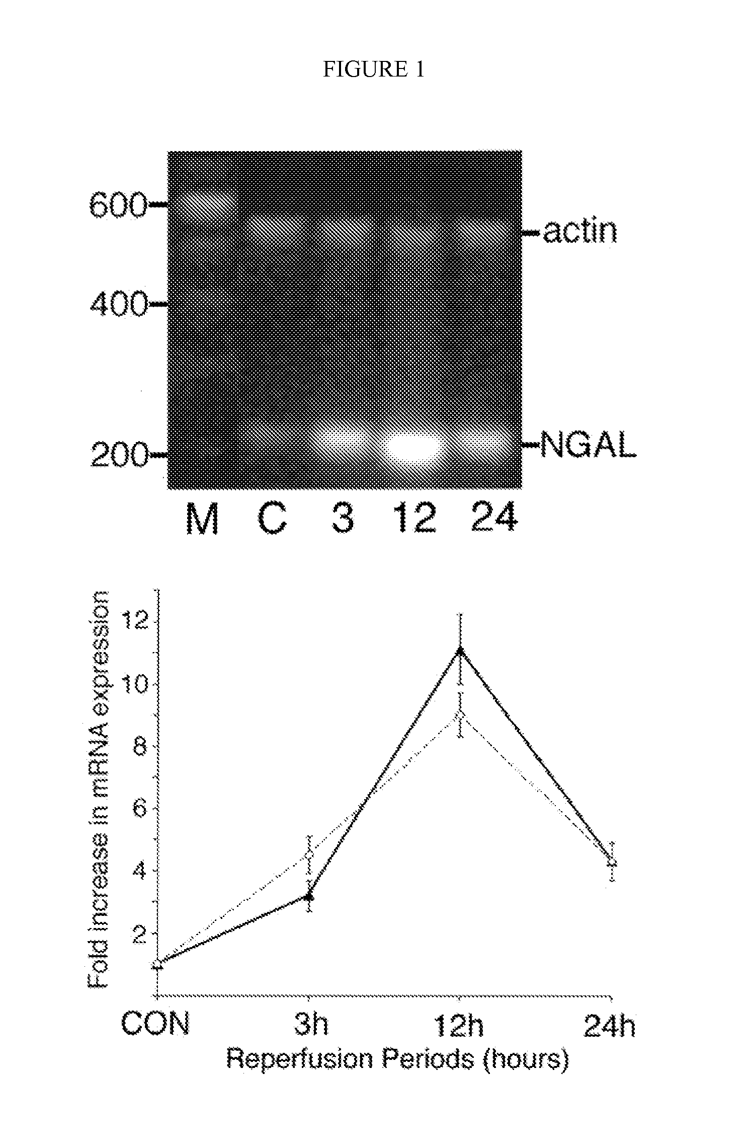 Method and kit for detecting the early onset of renal tubular cell injury