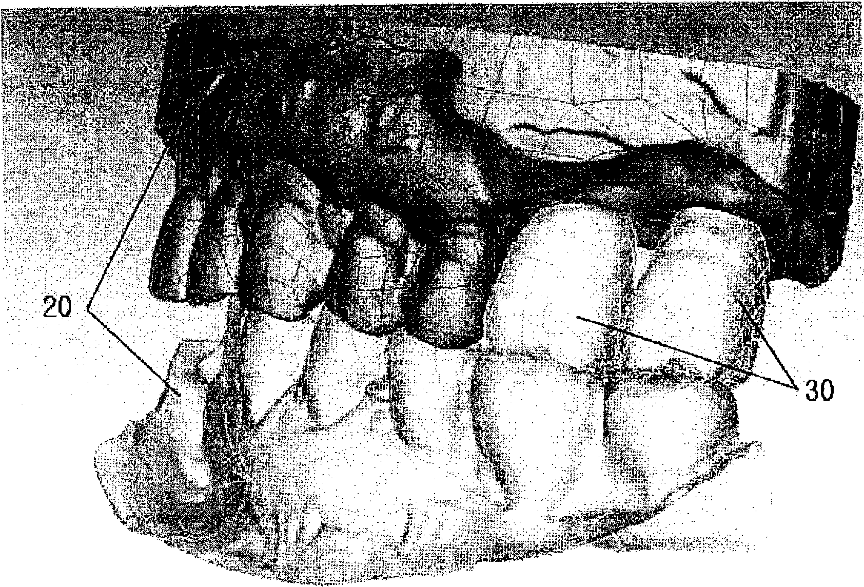 Method for manufacturing the one body abutment of an implant