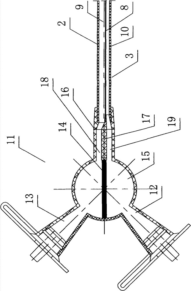 Adjustable double-cavity stomach tube