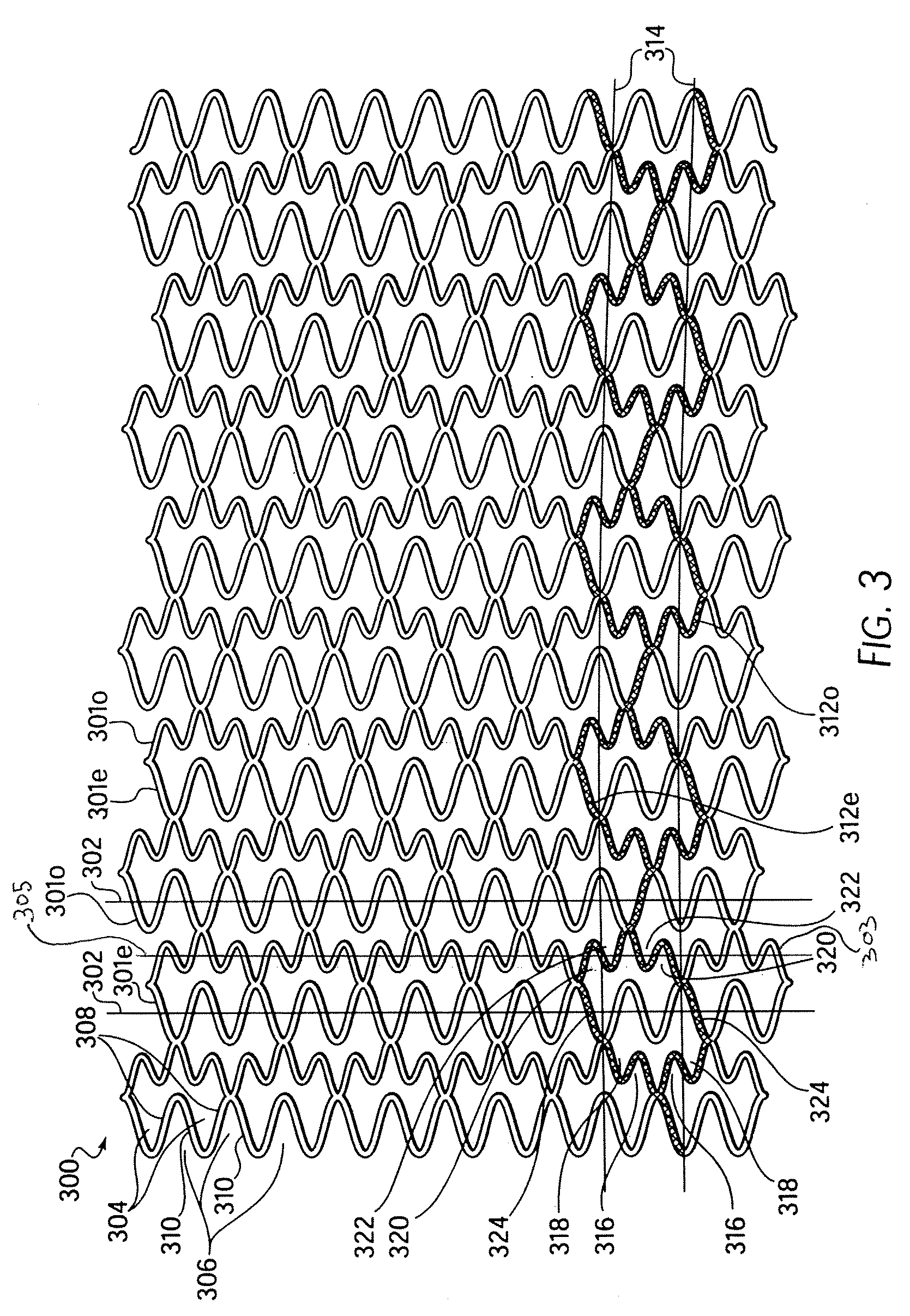 Longitudinally flexible stent