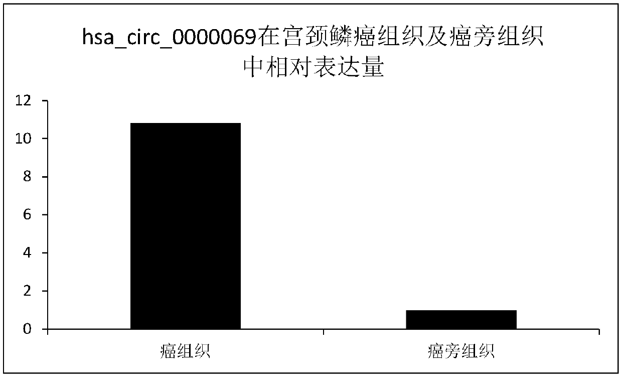 circRNA and application thereof in preparation of cervical cancer diagnostic reagent