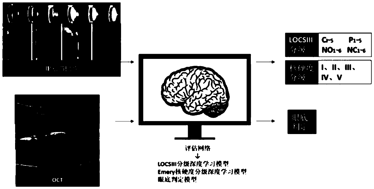 Operation intelligent decision-making system for high myopia cataract and an establishment method thereof