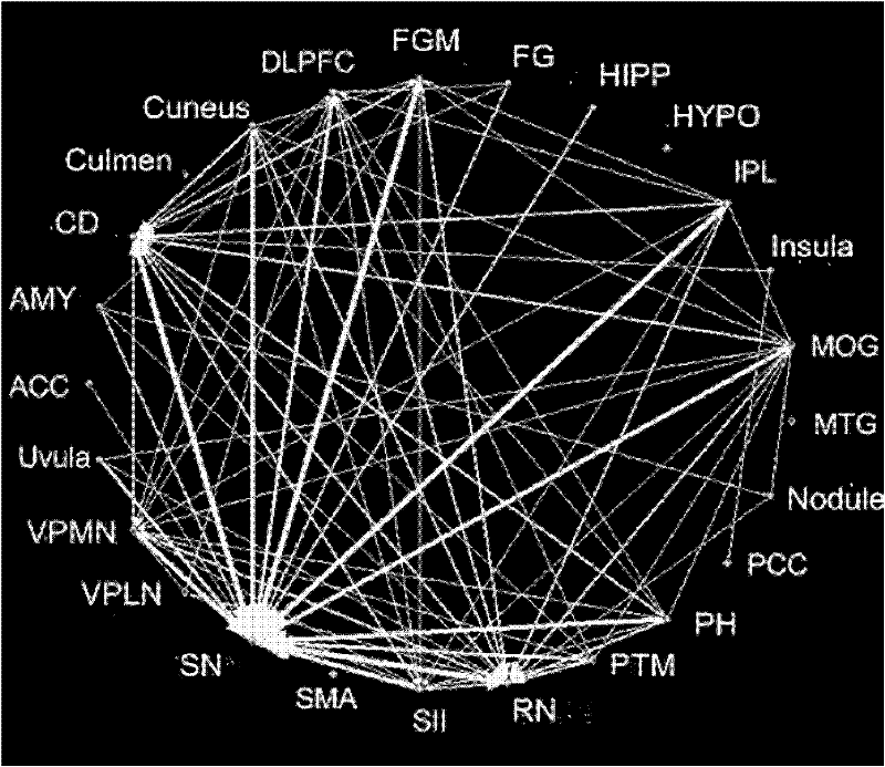 Method for constructing effective connectivity in brain region based on nuclear magnetic resonance imaging