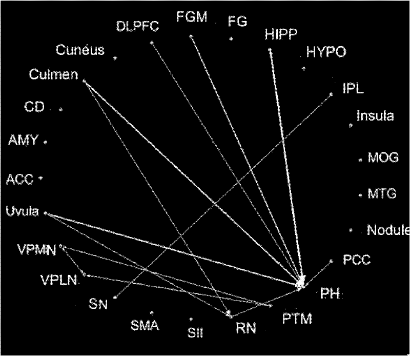 Method for constructing effective connectivity in brain region based on nuclear magnetic resonance imaging