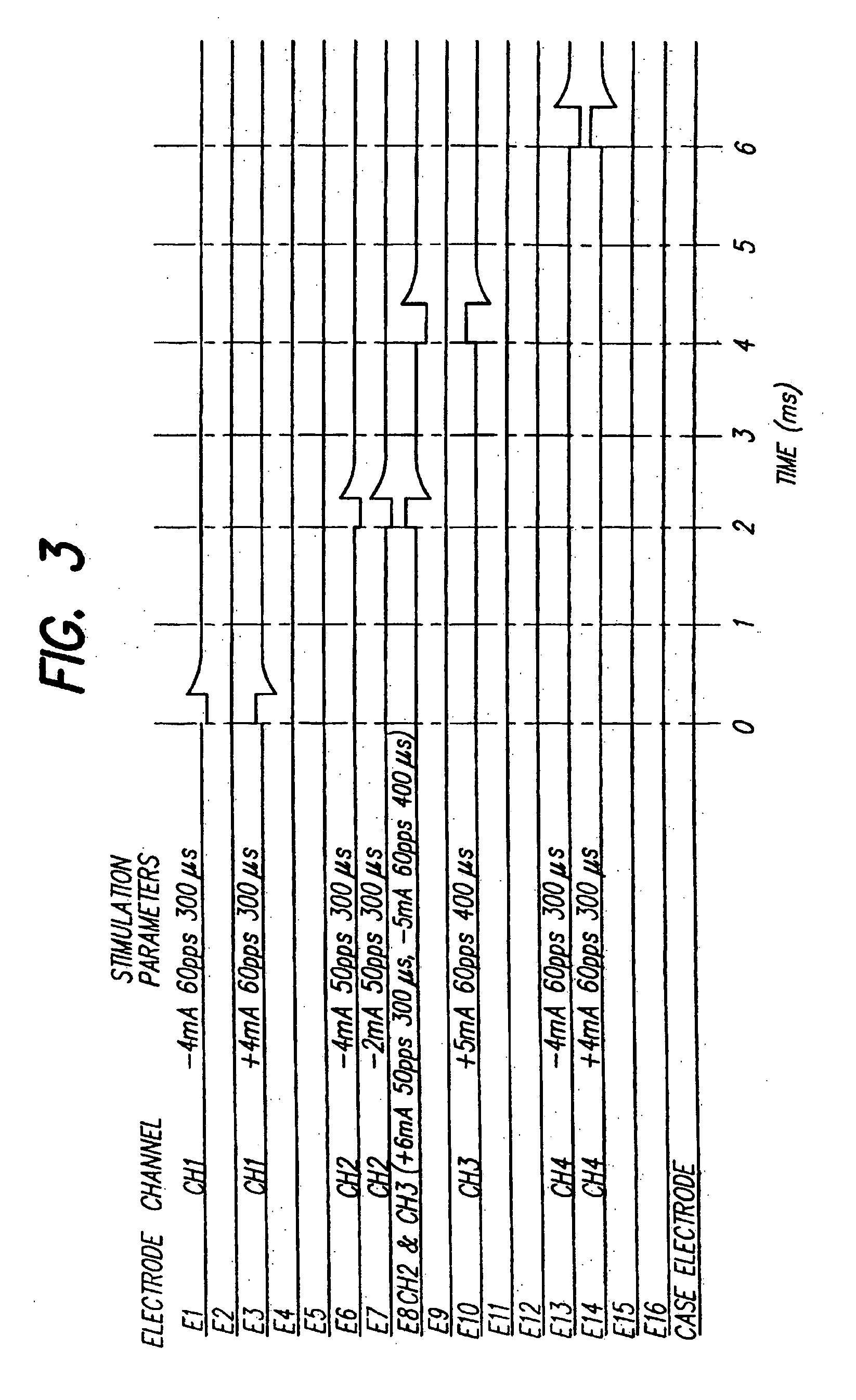 Expanding single channel stimulator capability on multi-area stimulation programs