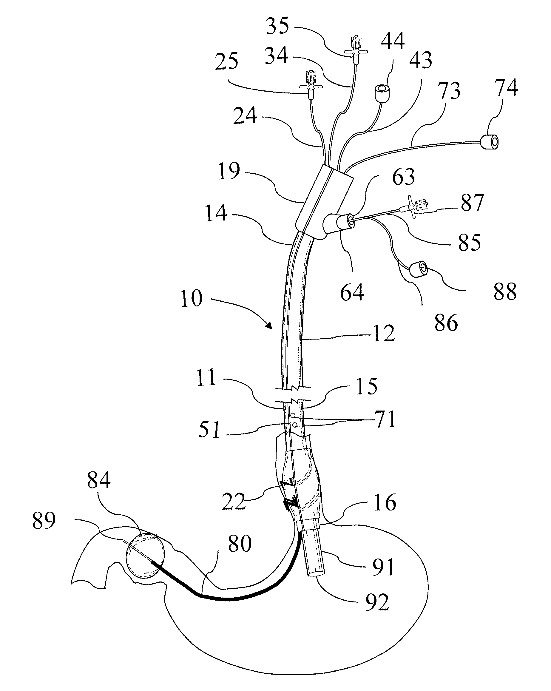 An endoscope accessory