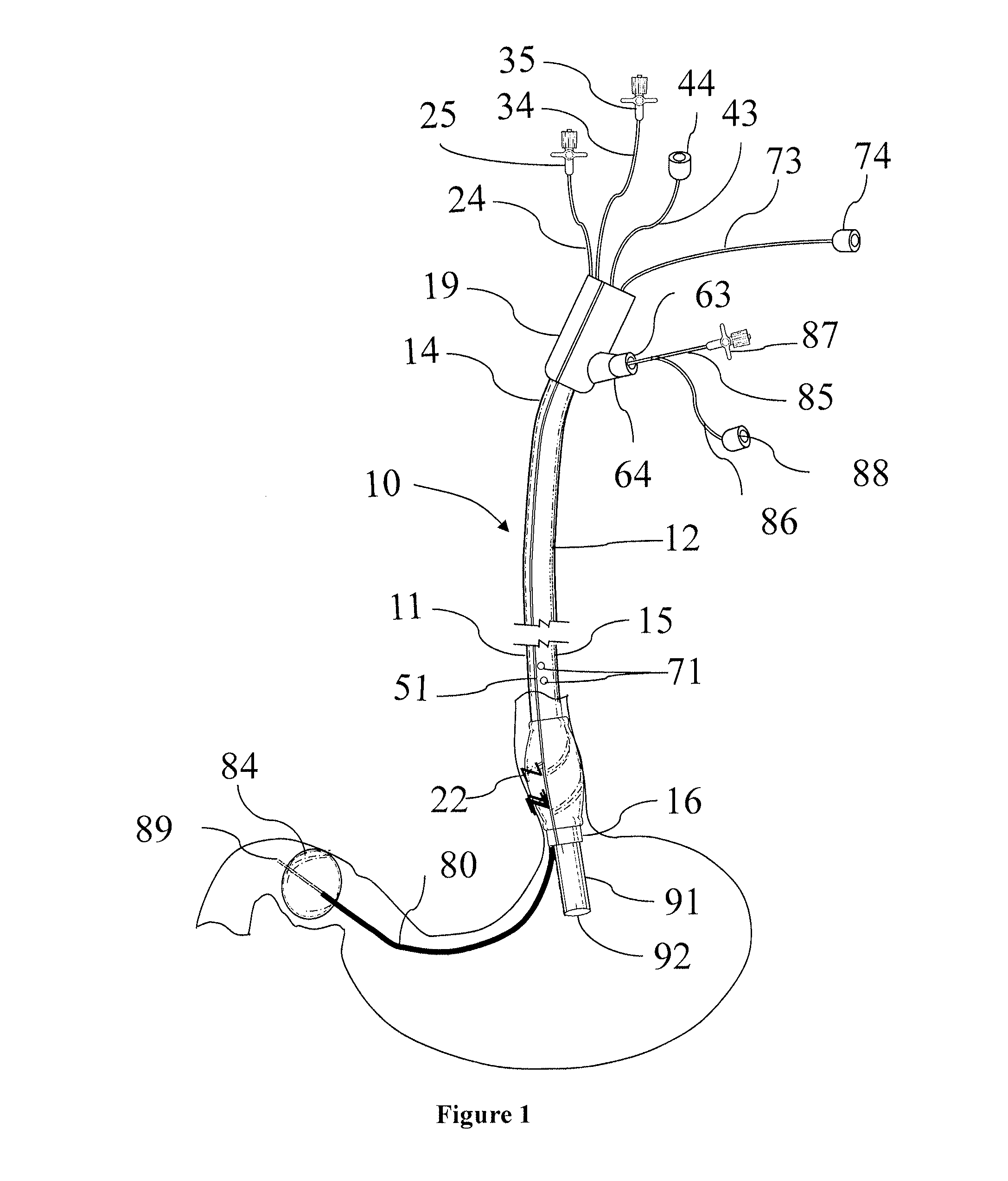 An endoscope accessory