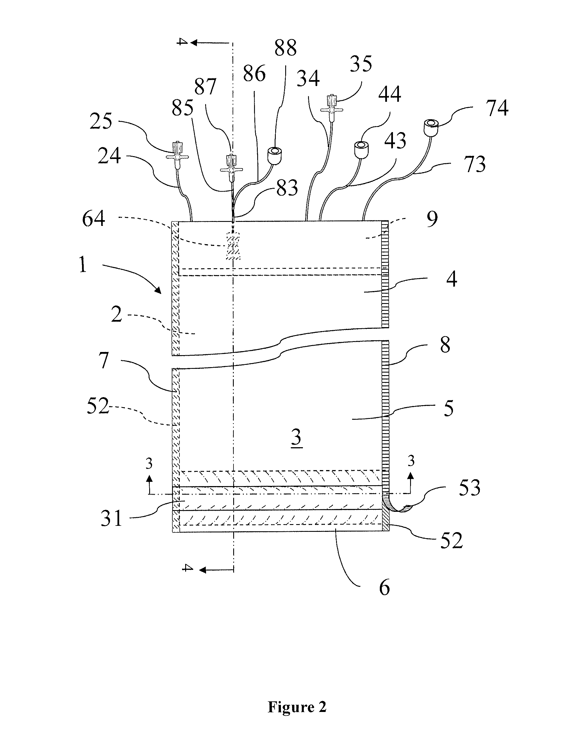 An endoscope accessory