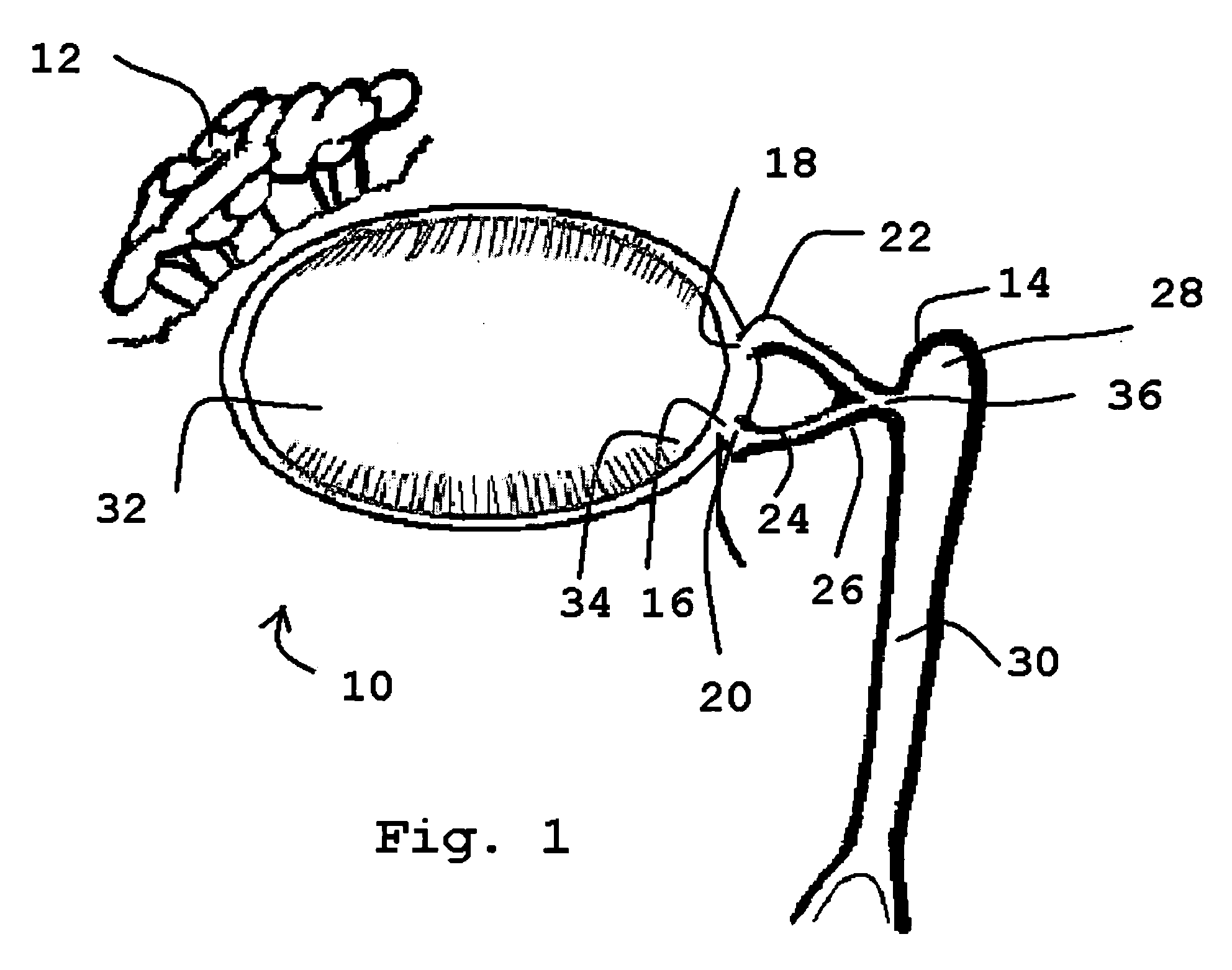 Lacrimal filler