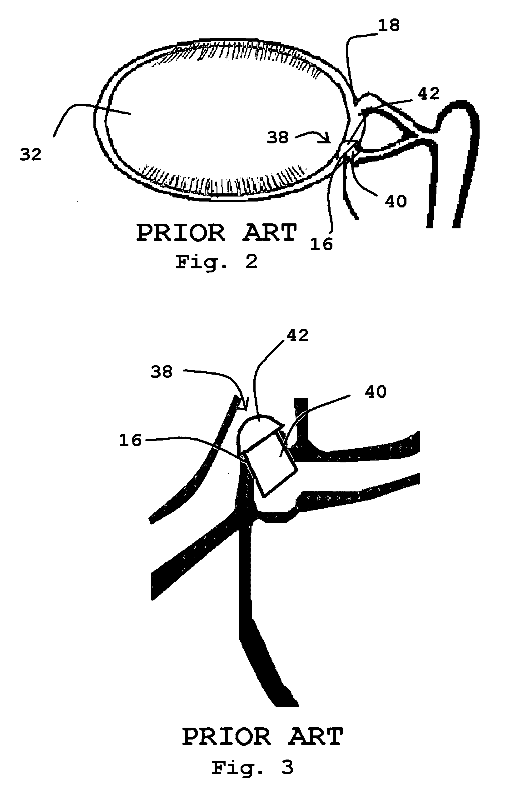 Lacrimal filler