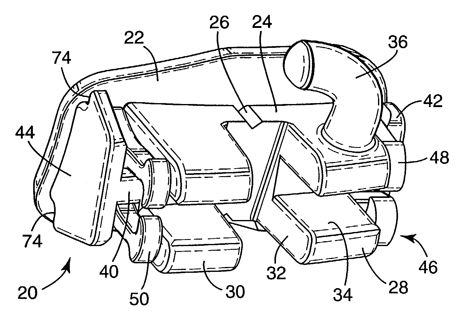 Molar appliance for orthodontic therapy