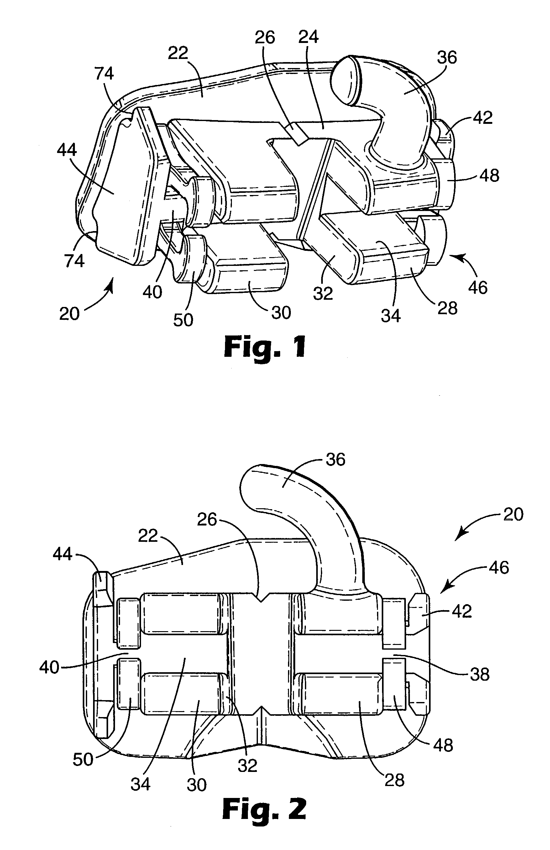 Molar appliance for orthodontic therapy