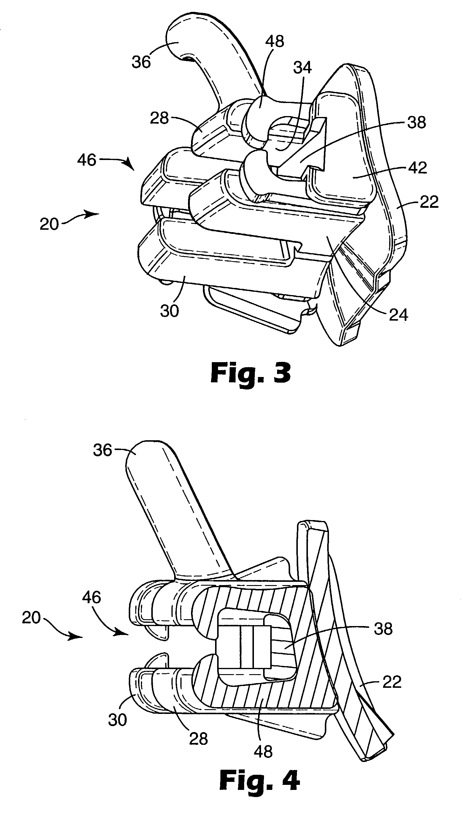 Molar appliance for orthodontic therapy