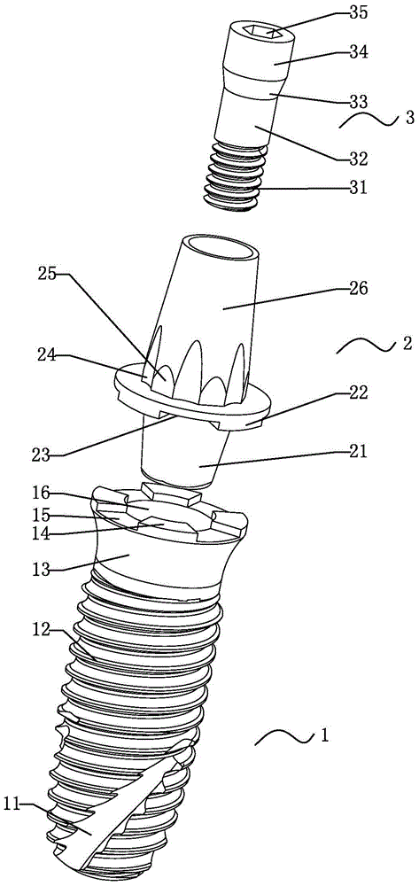 Anti-rotation implant device