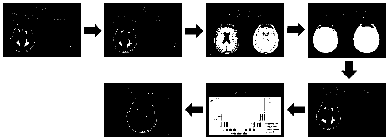 Method and device for segmenting brain white matter high signal based on deep learning method