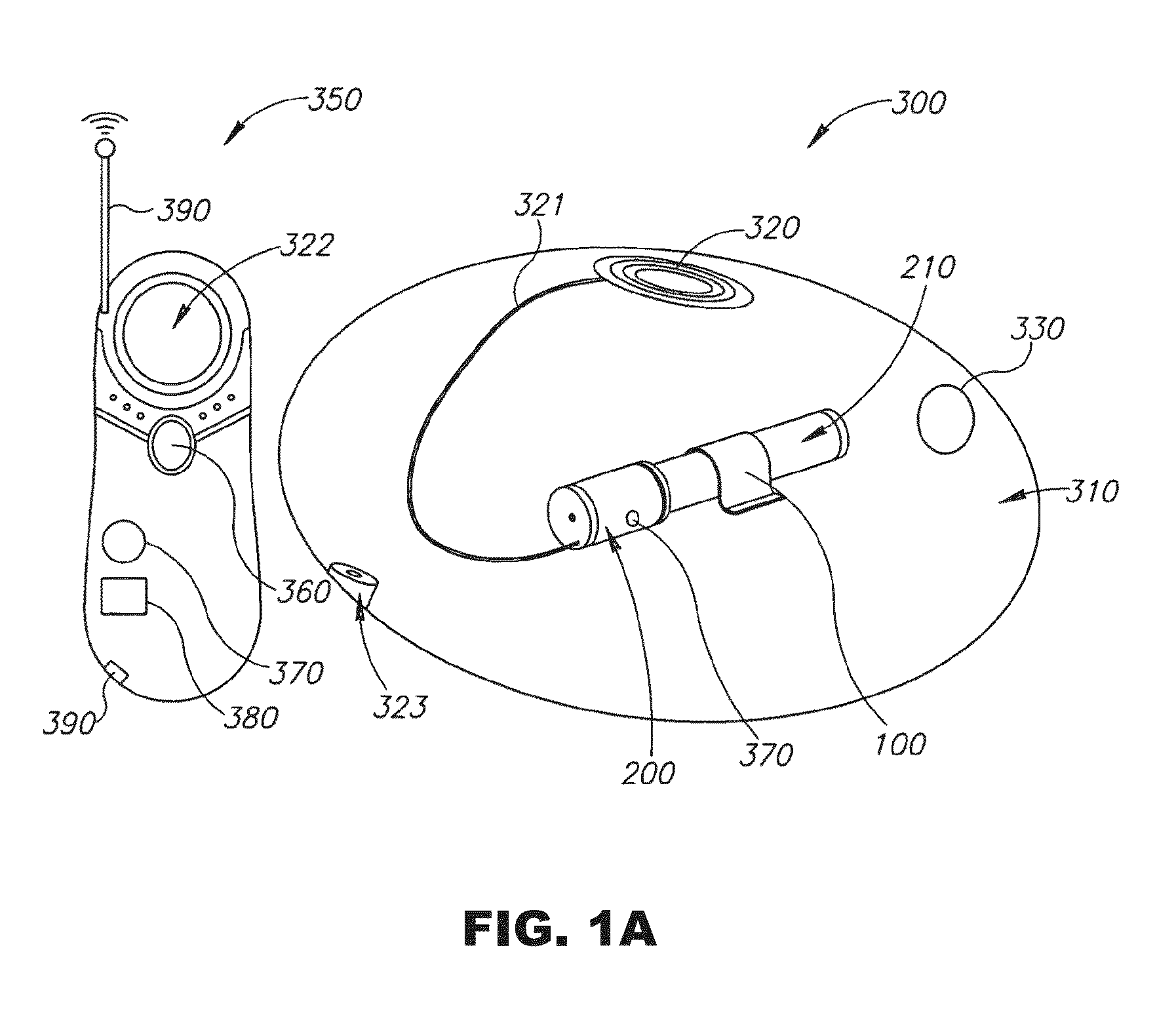 Tissue expanders, implants, and methods of use