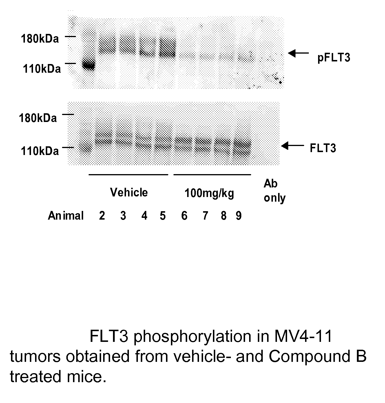 Synergistic modulation of flt3 kinase using a flt3 inhibitor and a farnesyl transferase inhibitor