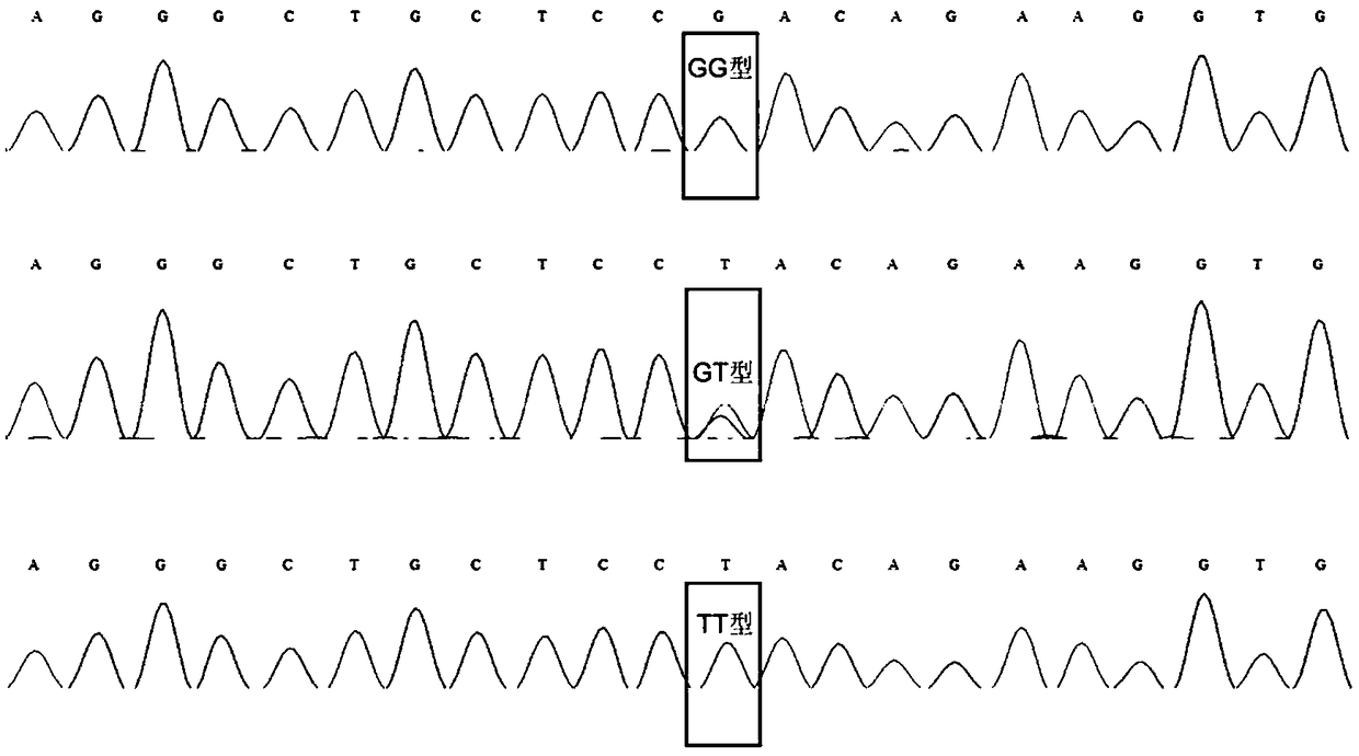 Molecular marker influencing duroc eye muscle area characters and application