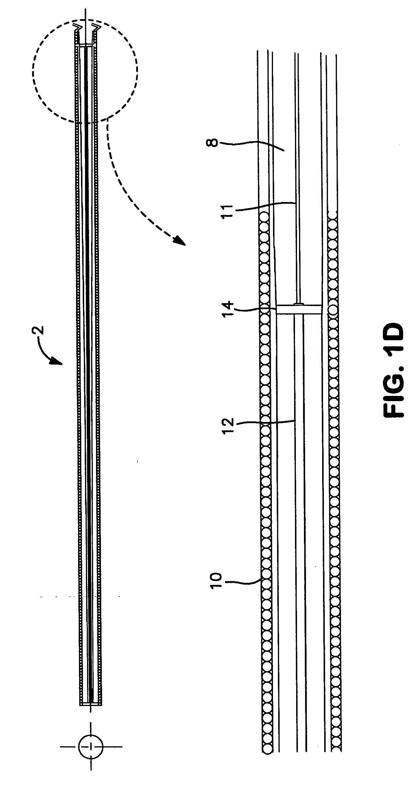 Vascular guidewire system