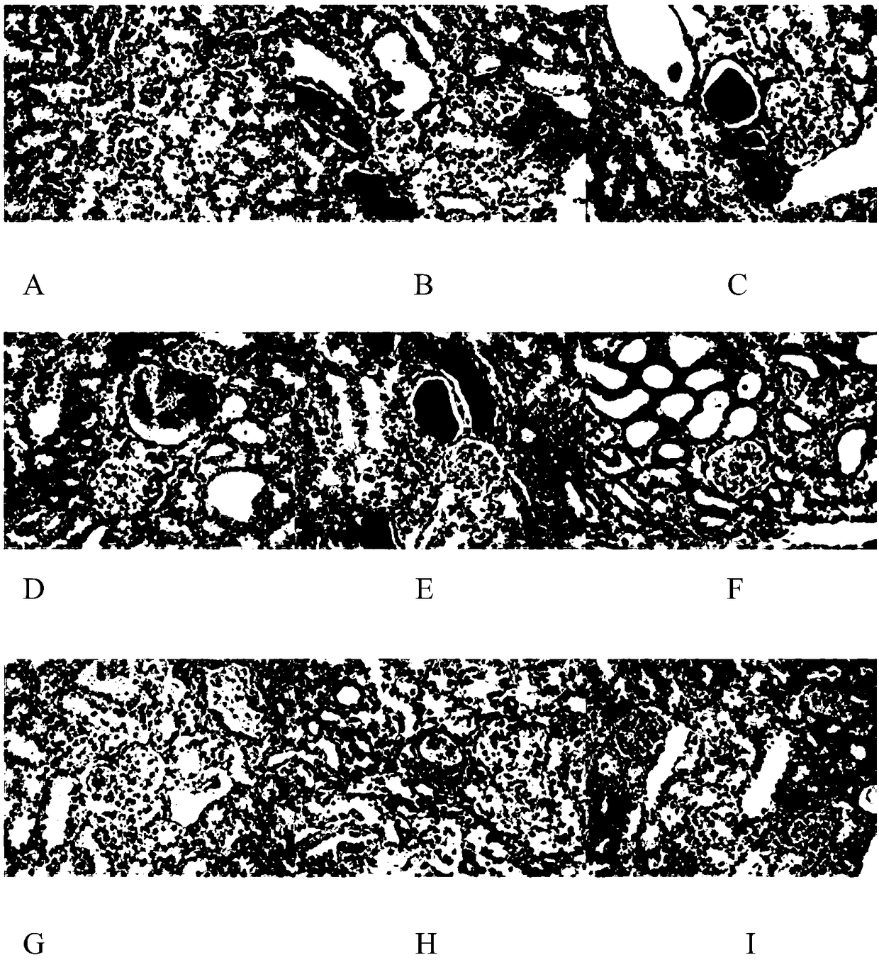 Application of emodin and combination of emodin and polydatin in treating metabolic syndrome