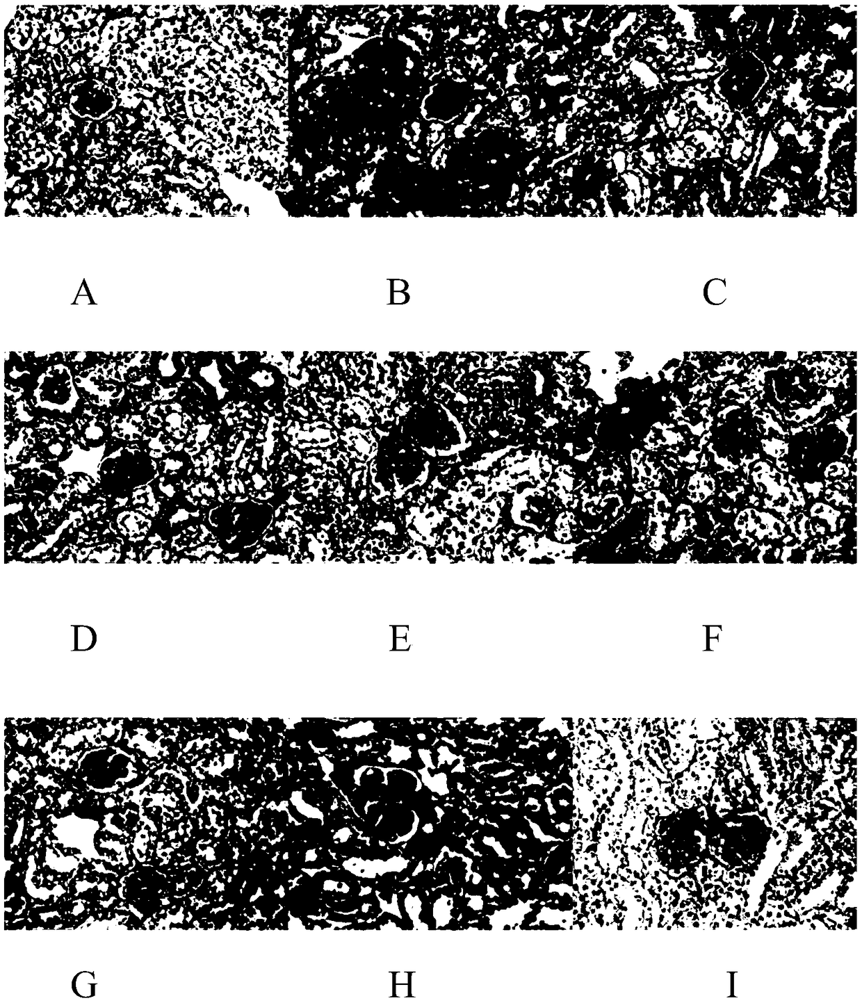 Application of emodin and combination of emodin and polydatin in treating metabolic syndrome